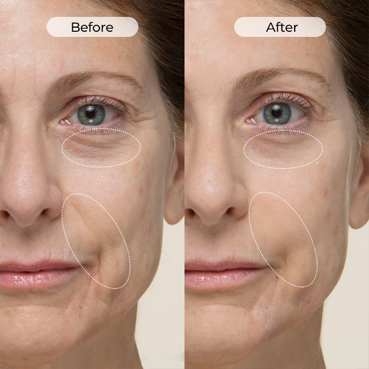 Rustii® TightShift Precision Contour & Firming Serum
